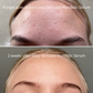 Mandelic Serum 5%